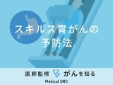 非公開: 「スキルス胃がんの予防法」はご存知ですか？医師が徹底解説！