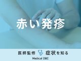 「赤い発疹」ができる原因はご存知ですか？正しい対処法も医師が解説！