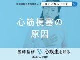 非公開: 「心筋梗塞の主な5つの原因」はご存知ですか？セルフチェック法も医師が解説！