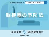 非公開: 「脳梗塞の予防法」や「発症しやすい人の特徴」はご存知ですか？【医師解説】