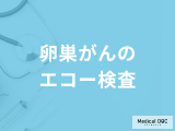「卵巣がんはエコー検査」で調べられる？検査費用や他の検査も医師が解説！