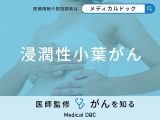 「浸潤性小葉がん」の症状・原因・ステージ別の治療法はご存知ですか？医師が解説！