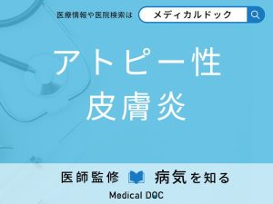 アトピー性皮膚炎