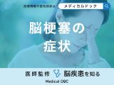 非公開: 「脳梗塞の代表的な5つの症状」はご存知ですか？医師が徹底解説！