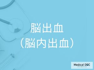 脳出血（脳内出血）