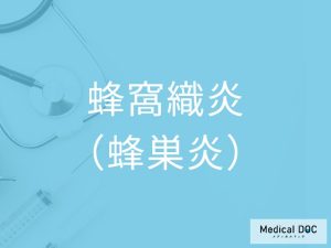 蜂窩織炎（蜂巣炎）