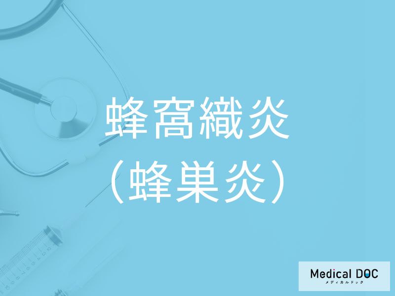 蜂窩織炎（蜂巣炎）