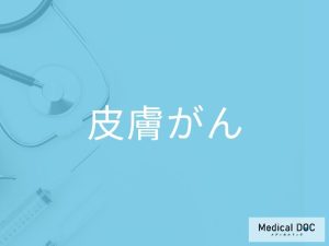 皮膚がん