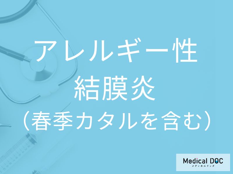 アレルギー性結膜炎（春季カタルを含む）