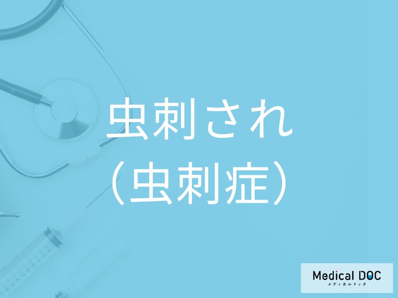 虫刺され（虫刺症）