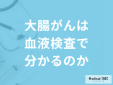 「大腸がんは血液検査」で発見できるのか？5つの初期症状も医師が解説！