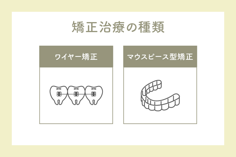 矯正治療の種類