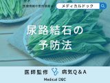非公開: 「尿路結石」を予防する食べ物・飲み物をご存知ですか？