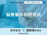 非公開: 「脳梗塞の初期症状」はご存知ですか？医師が徹底解説！