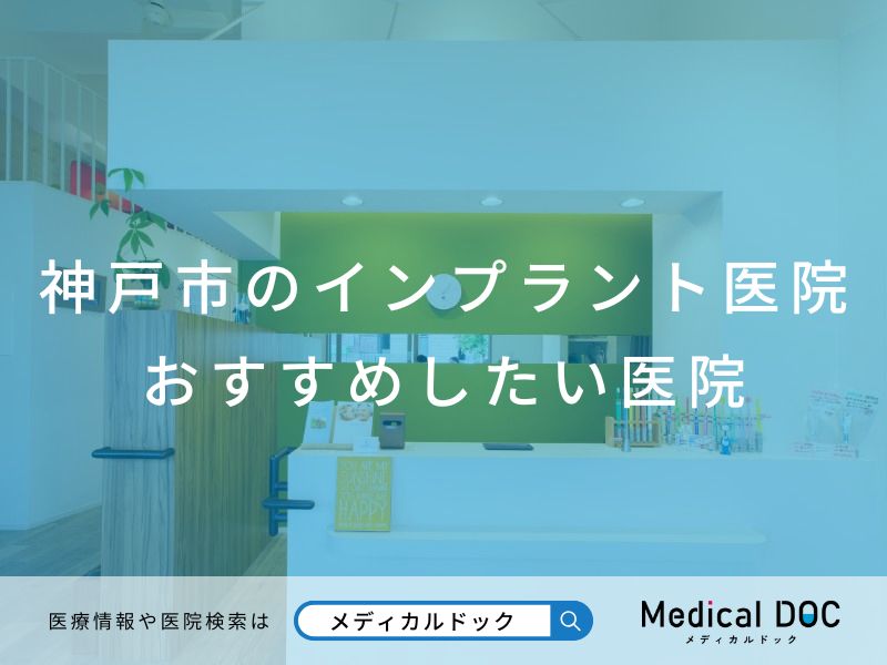 神戸市のインプラント医院 おすすめしたい医院