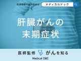 「肝臓がんの末期症状」はご存知ですか？余命一ヶ月の症状も医師が解説！
