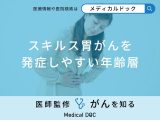 「スキルス胃がんを発症しやすい年齢層」はご存知ですか？なりやすい人の特徴も解説！