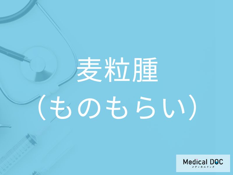 麦粒腫（ものもらい）