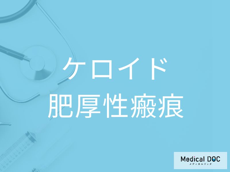 ケロイド、肥厚性瘢痕