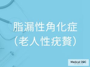 脂漏性角化症（老人性疣贅）