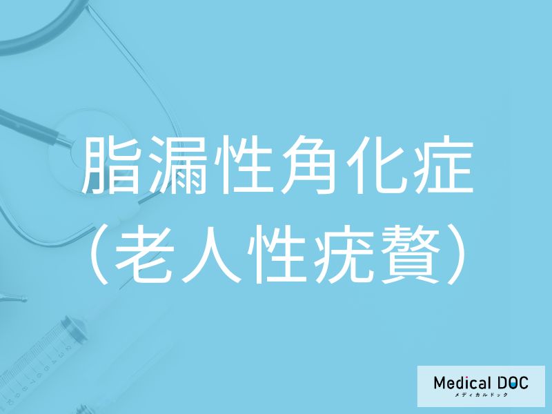 脂漏性角化症（老人性疣贅）