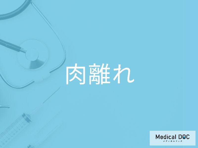 肉離れ