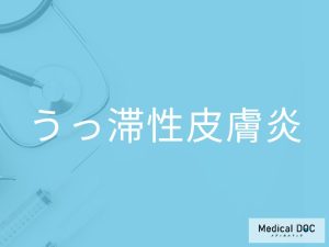 うっ滞性皮膚炎