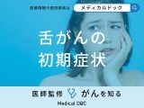 非公開: 「舌がんの前兆となる6つの初期症状」はご存知ですか？【医師監修】