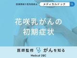 非公開: 「花咲乳がんの前兆となる3つの初期症状」はご存知ですか？医師が徹底解説！