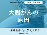 非公開: 「大腸がんの主な5つの原因」はご存知ですか？医師が徹底解説！