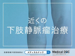 近くのおすすめの下肢静脈瘤治療