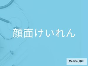 顔面けいれん