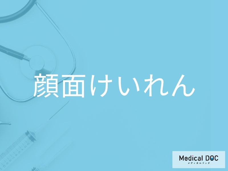 顔面けいれん