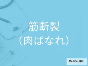 筋断裂（肉ばなれ）