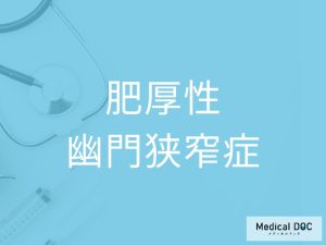 肥厚性幽門狭窄症