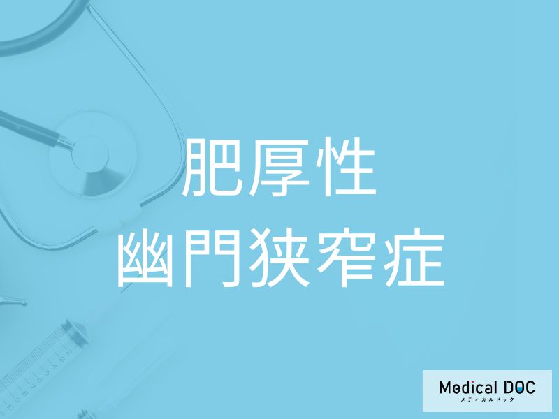 肥厚性幽門狭窄症