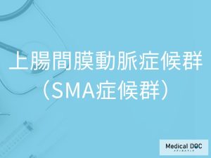 上腸間膜動脈症候群（SMA症候群）