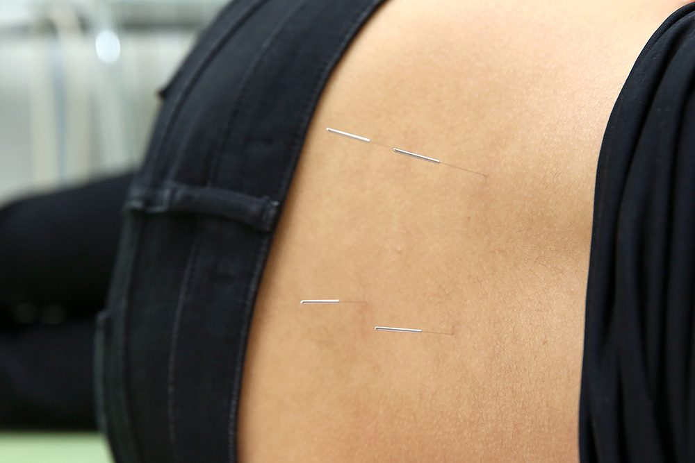 にしはち健幸堂鍼灸・接骨院photo