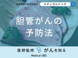 非公開: 「胆管がんを予防」するために控えた方がいい「食べ物」はご存知ですか？医師が解説！