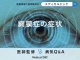 「網膜症の症状」はご存知ですか初期症状・末期症状も解説！【医師監修】