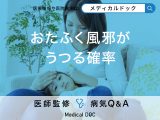 「おたふく風邪がうつる確率」はどのくらいかご存知ですか？予防法も解説！【医師監修】