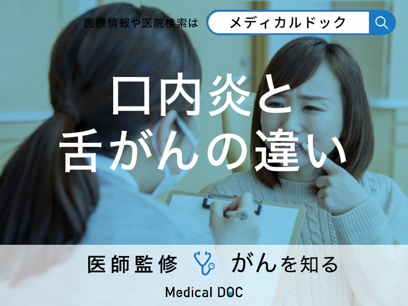 「口内炎」と「舌がん」の違いとは?見分け方や受診の目安を解説【医師監修】