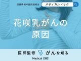 非公開: 「花咲乳がんの原因」はご存知ですか？医師が徹底解説！
