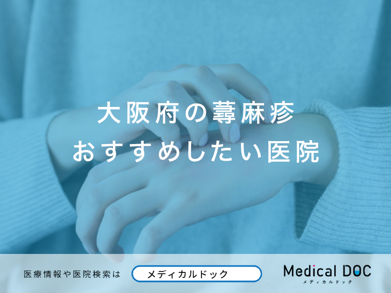 大阪府の蕁麻疹おすすめしたい医院
