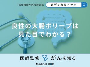 「良性の大腸ポリープ」は見た目でわかるの？悪性の大腸ポリープの特徴も医師が解説！