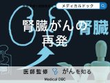「腎臓がんが再発率」はご存知ですか？再発したときの治療法も解説！