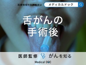 「舌がん手術後」に起こりうる「変化」をご存じですか？【医師監修】