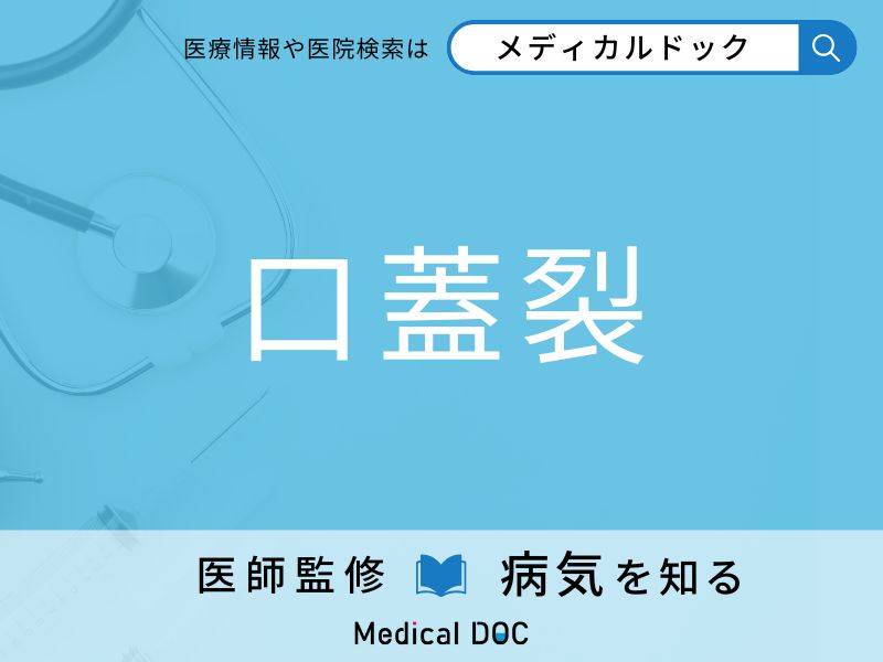 口蓋裂