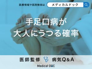 「手足口病が大人にうつる確率」はどれくらい？症状や出勤停止期間も解説！