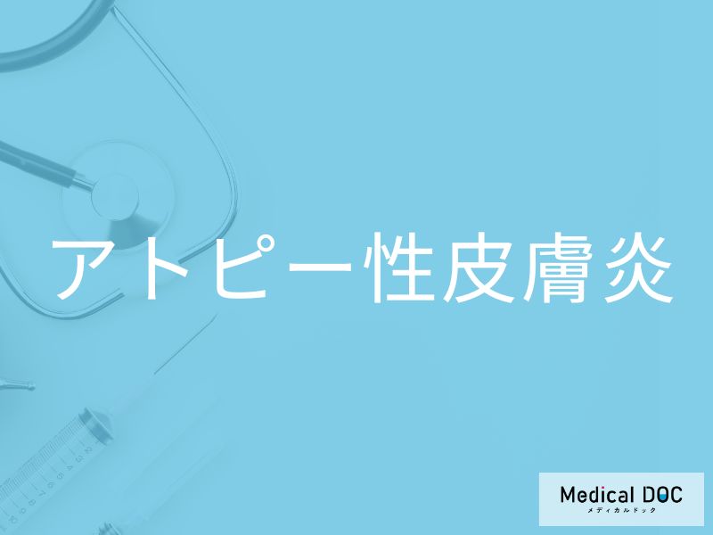 アトピー性皮膚炎